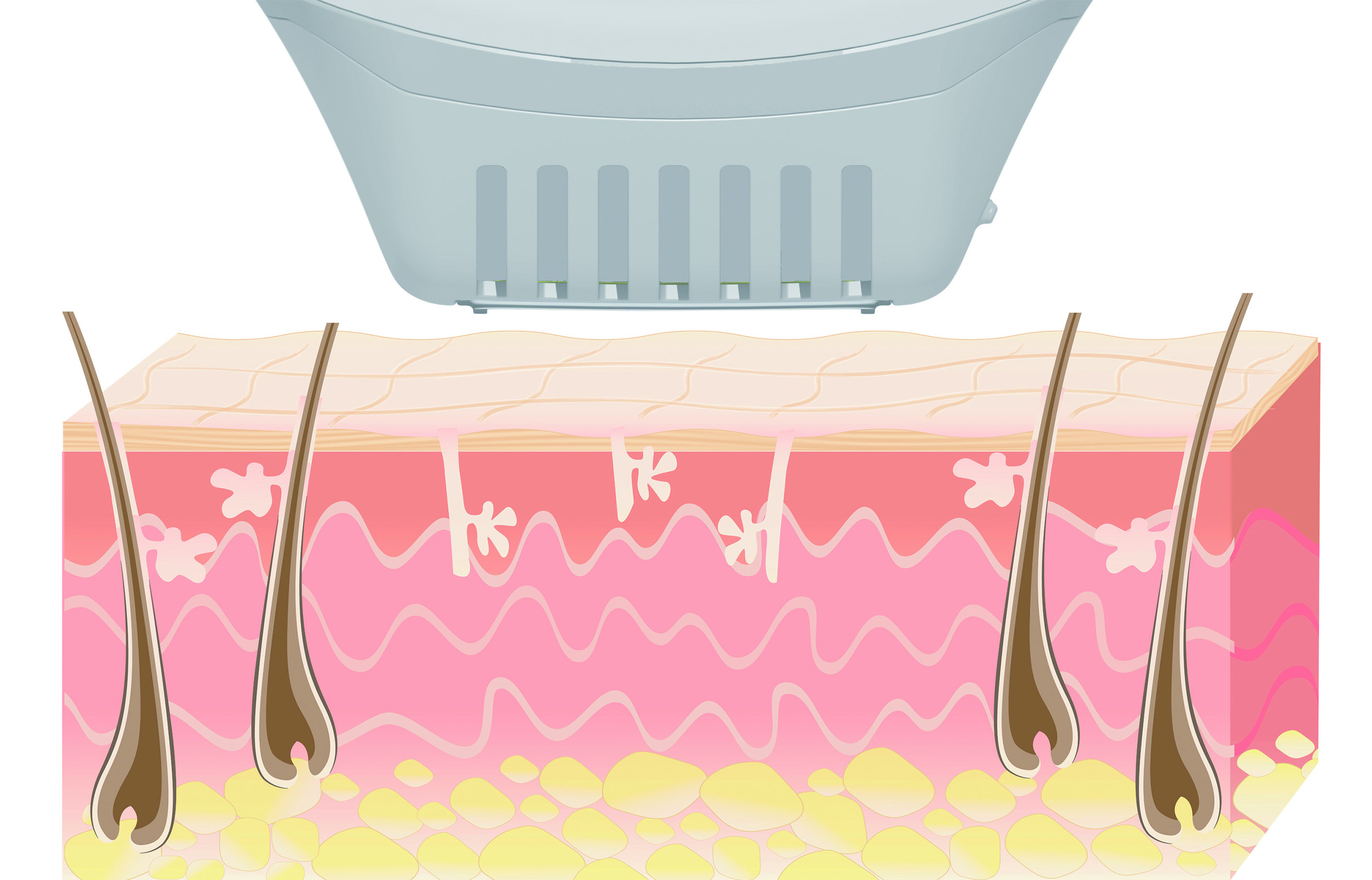 Epilateur lumière pulsée BEURER IPL 10000+ SalonPro System - IPL10000PLUS