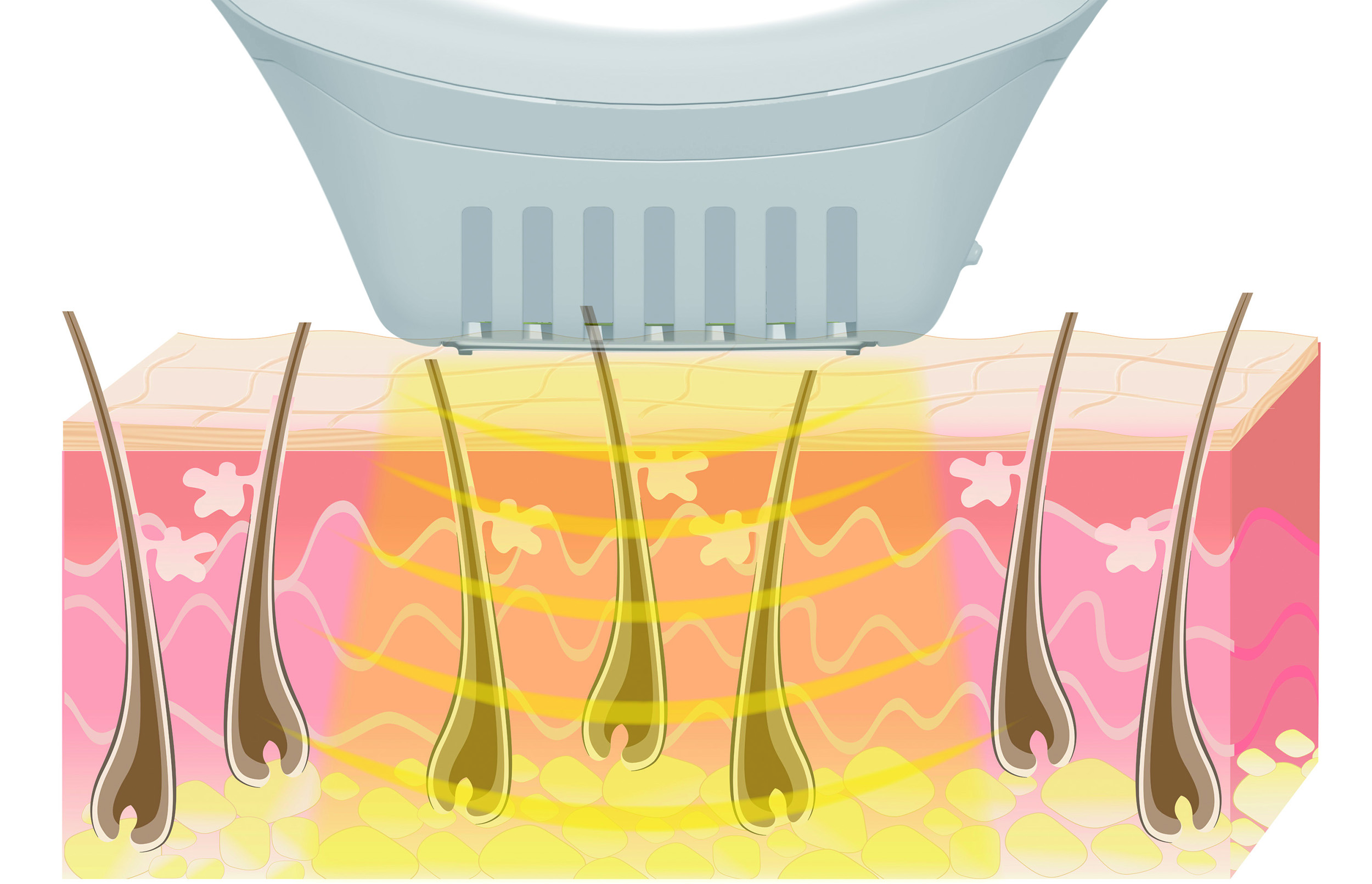 Epilateur lumière pulsée BEURER IPL 10000+ SalonPro System - IPL10000PLUS