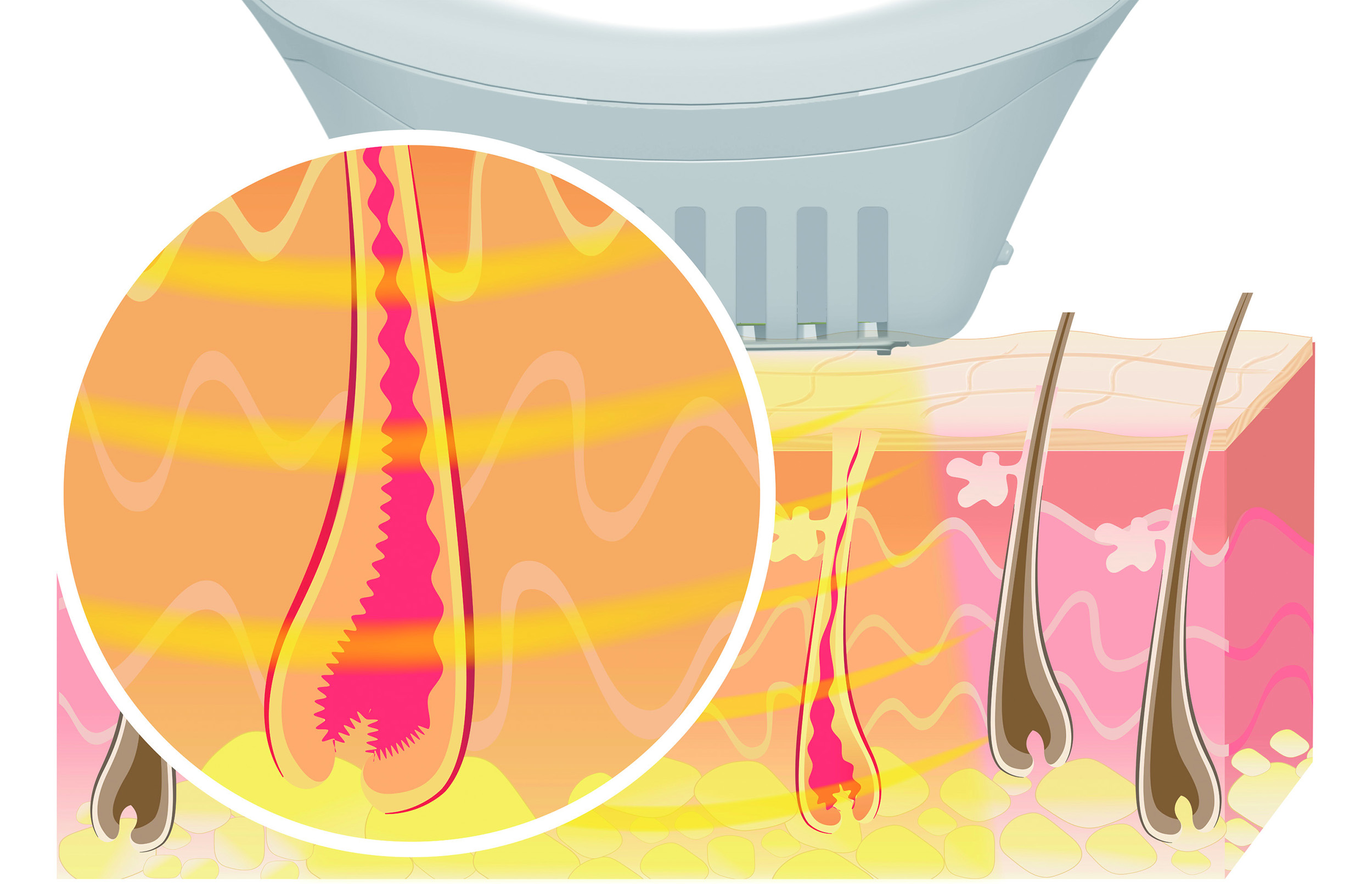 Epilateur lumière pulsée BEURER IPL 10000+ SalonPro System - IPL10000PLUS